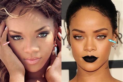 Rihanna's Eye Color | Plastic surgery photos, Bad plastic surgeries, Celebrity plastic surgery