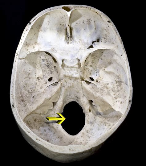 ファイル:Crane4 Foramen magnum.png - Wikipedia