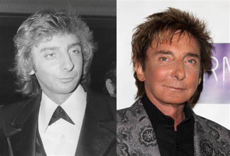 Barry Manilow before and after plastic surgery – Celebrity plastic ...