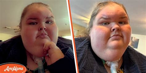 Why Is Tammy Slaton's Forehead Attracting Attention? '1000-Lb Sisters' Fans Discuss the Star