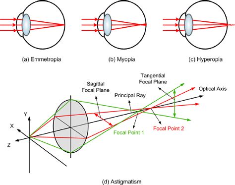 Table 2.1 from The depth of focus of the human eye. | Semantic Scholar