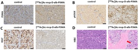 Representative histological images of tumor sections. (A) Untreated... | Download Scientific Diagram