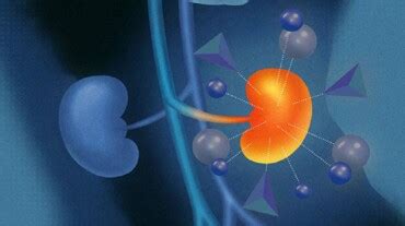 Kidney Cancer: Know the 4 Stages of This Disease | HealthShots