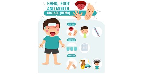 Hand, Foot, & Mouth Disease (HFMD): Symptoms, Causes & Treatments