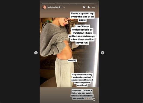 'I have a cyst… Not a baby': Hailey Bieber Debunks Pregnancy Rumors ...