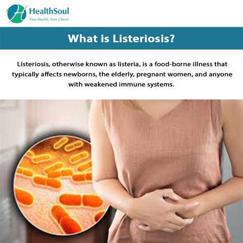 Listeriosis: Symptoms and Treatment – Healthsoul