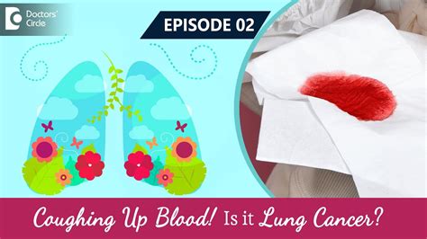 Coughing Up Blood (Hemoptysis)| Is it Lung Cancer? Visit a doctor | Dr.Sandeep Nayak & Dr ...