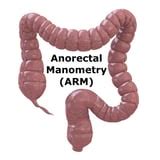 How to Interpret Conventional Anorectal Manometry