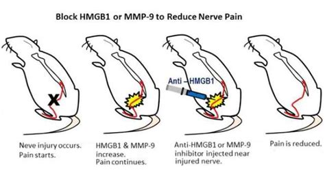 New targets for reducing nerve pain identified | Technology Networks