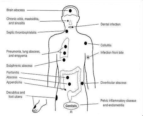 Anaerobes