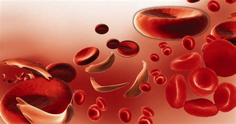 Anemia hemolítica: tipos, sintomas, causas e tratamento