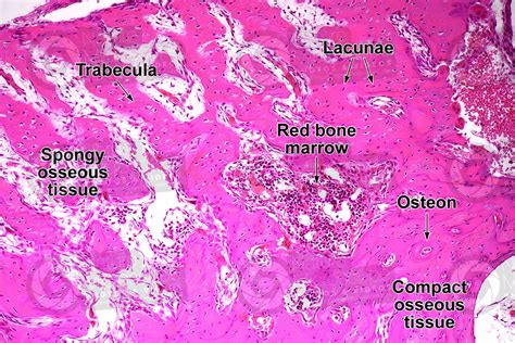 Mammal. Spongy osseous tissue. Transverse section. 125X - Spongy osseous tissue - Osseous tissue ...