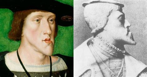 The “Hadsburg Jaw” became so prominent, Charles II had difficulty in ...