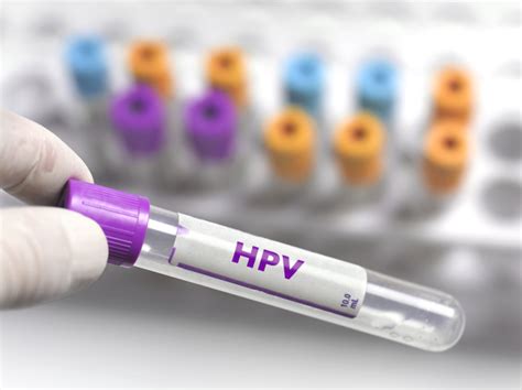 How HPV Can Play Out Over Your Lifetime