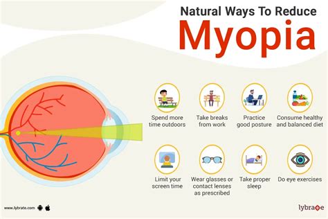 What to Know About Myopia: Causes, Complications and Natural Remedies