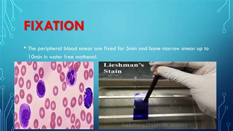 leishman stain procedure - YouTube