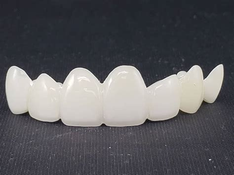 Crown and Bridge Restorations - First Choice Dental Lab