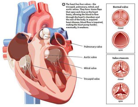 Acquired Heart Valve Disease Symptoms: Tiredness, Chest Pain, Swelling ...