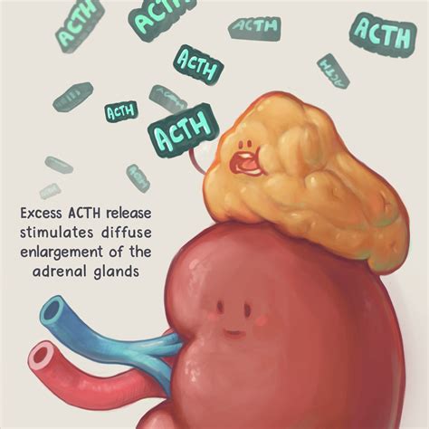 Congenital Adrenal Hyperplasia — artibiotics