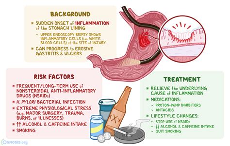 Acute Gastritis: What Is It, Causes, Symptoms | Osmosis