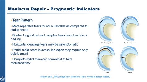 3 Types of Meniscus Tear Treatment | Knee Specialist | Baton Rouge, LA