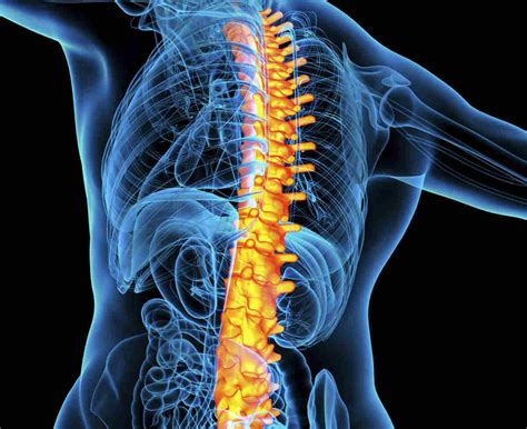 Types Of Spinal Fractures Radiology - Design Talk