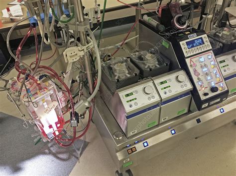 Heart Lung Machine - Stock Image - C043/6421 - Science Photo Library