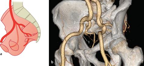 Obturator Artery | Radiology Key