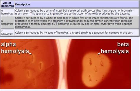 Different types of bacterial hemolysis on blood agar | Medical Laboratories