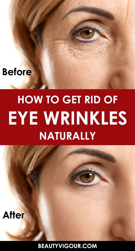 How To Get Rid Of Eye Wrinkles Naturally | Eye wrinkle, Wrinkles ...