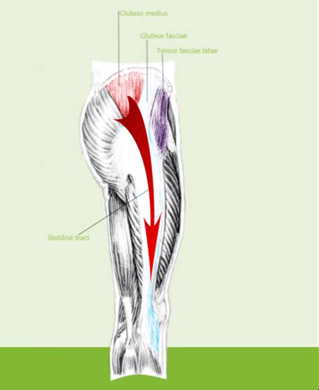 Greater Trochanteric Pain Syndrome - Physiopedia