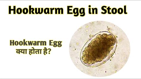 Hookworm eggs under microscope | Egg of Hookworm | Hookwarm Egg in Stool - YouTube