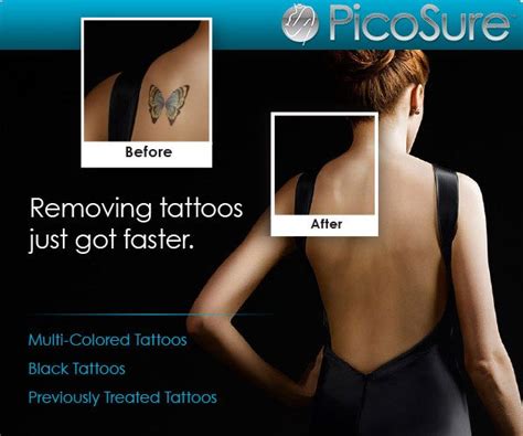 Tattoo Removal In Cincinnati, OH | Advanced Cosmetic