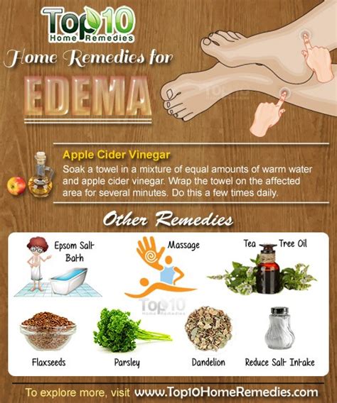 Home Remedies for Edema | Top 10 Home Remedies