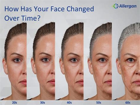 Facial Aging | Hotch Laser Green Bay