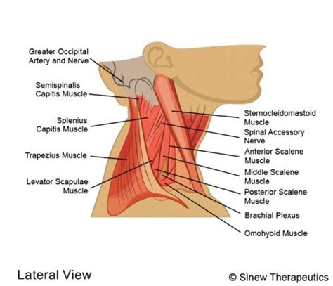 Metropolitan Headache And Spine Center - Headache