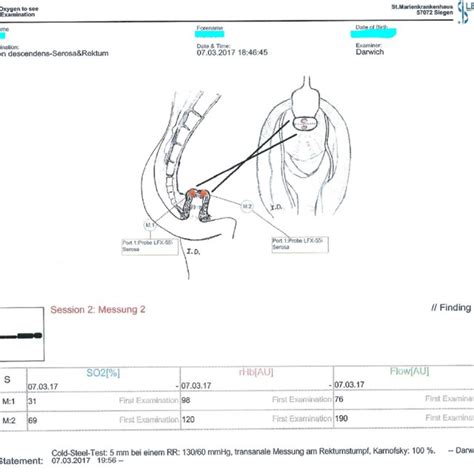 Points of probe placement | Download Scientific Diagram