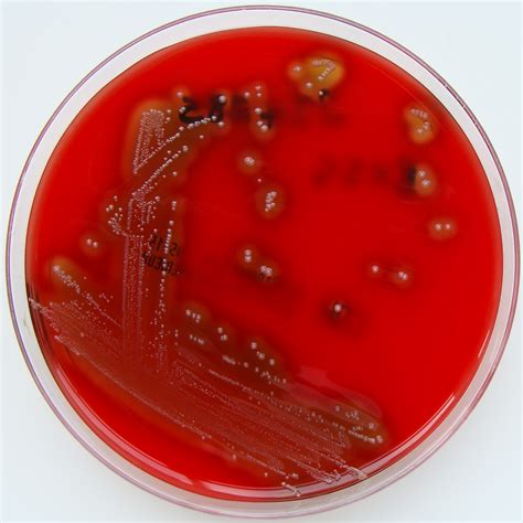 File:Streptococcus pyogenes (Lancefield Group A) on Columbia Horse Blood Agar.jpg - Wikimedia ...