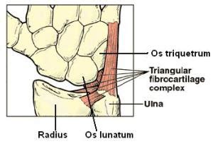 TFCC Injury: the "meniscus tear" of the wrist — ACRO Physical Therapy & Fitness