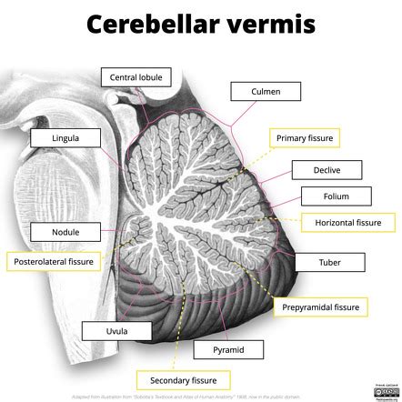 Cerebellar Vermis Tonsils