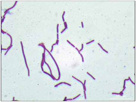 Lactobacillus Gram Stain