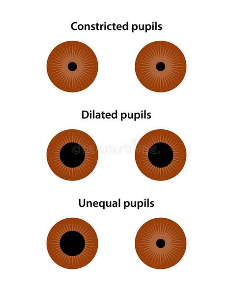 Human Eye. the Pupil Size in Different Lighting. Stock Vector ...