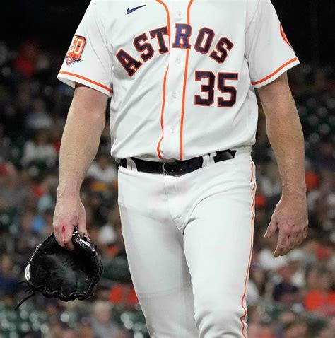 Why Astros' Justin Verlander had a bloody hand during start