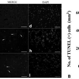 Immunofluorescent triple-labeling staining of deoxynucleotidyl ...