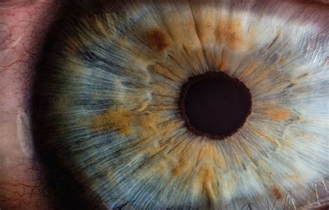 The Human Eye - Diseases & Disorders - CPD