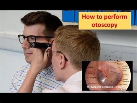 How to perform Otoscopy (Ear Exam) - YouTube