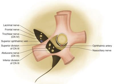 Superior Orbital Fissure Syndrome - EyeWiki