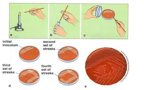 Colony isolation technique | Medical Laboratories