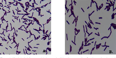 Figure 1 from Screening and evaluation of Lactobacillus spp. for the development of potential ...