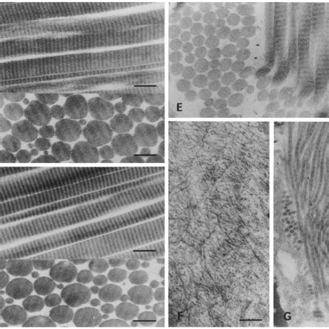 Transmission electron microscopy of collagen fibrils from tendon, skin... | Download Scientific ...